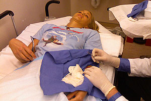 graphic image of dog bite