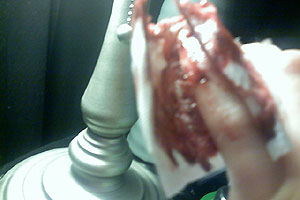 graphic image of dog bite